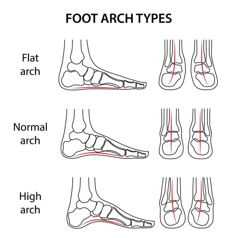 How Wide Feet Can Cause Pain